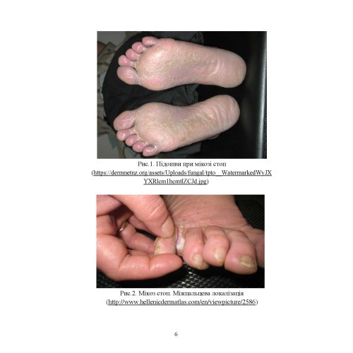 Подологічна допомога військовослужбовцям на догоспітальному етапі